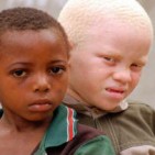 El nen albí africà