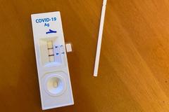 Test rápido coreano de Covid-19, a prueba en algunos hospitales de Italia.