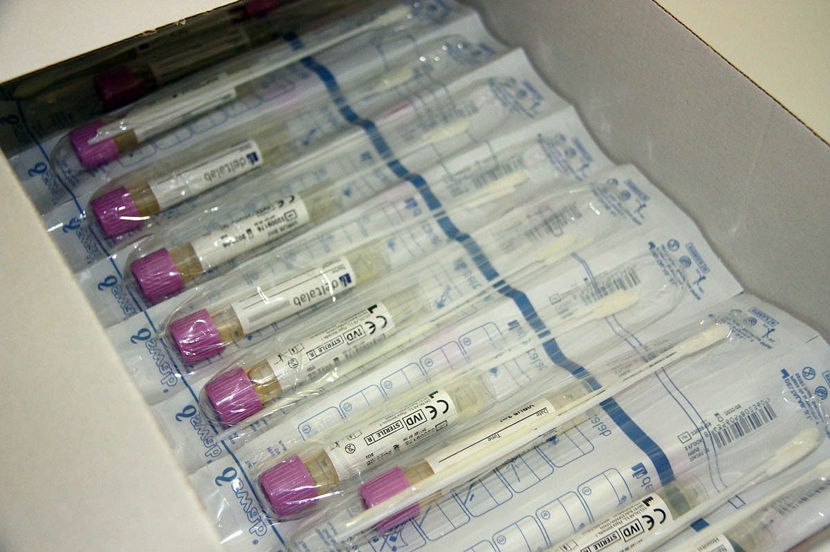Primer pla de proves PCR