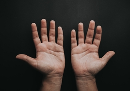 Algunas señales de las manos pueden indicar falta de vitaminas.