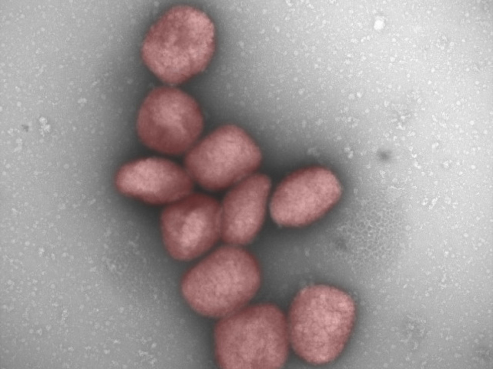 EuropaPress 4850128 particulas virus viruela mono tenidas rojo